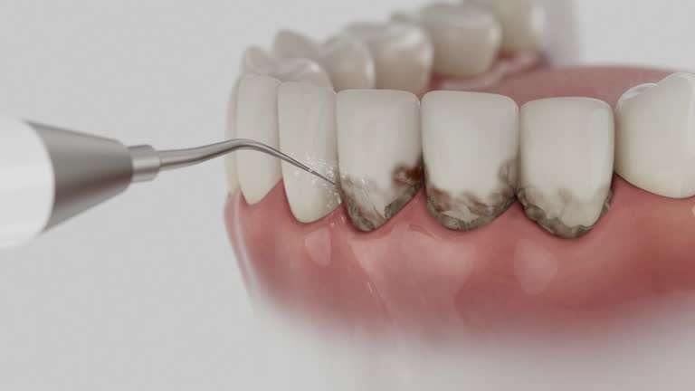 Reliable Dental Implants contractor in Ferriday, LA by Smile Center Dentistry